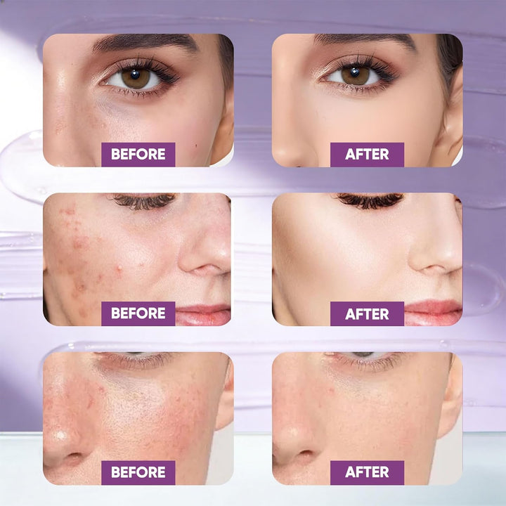 SKYNFLOW Máscara facial de colágeno + suero PDRN de péptidos volumi...