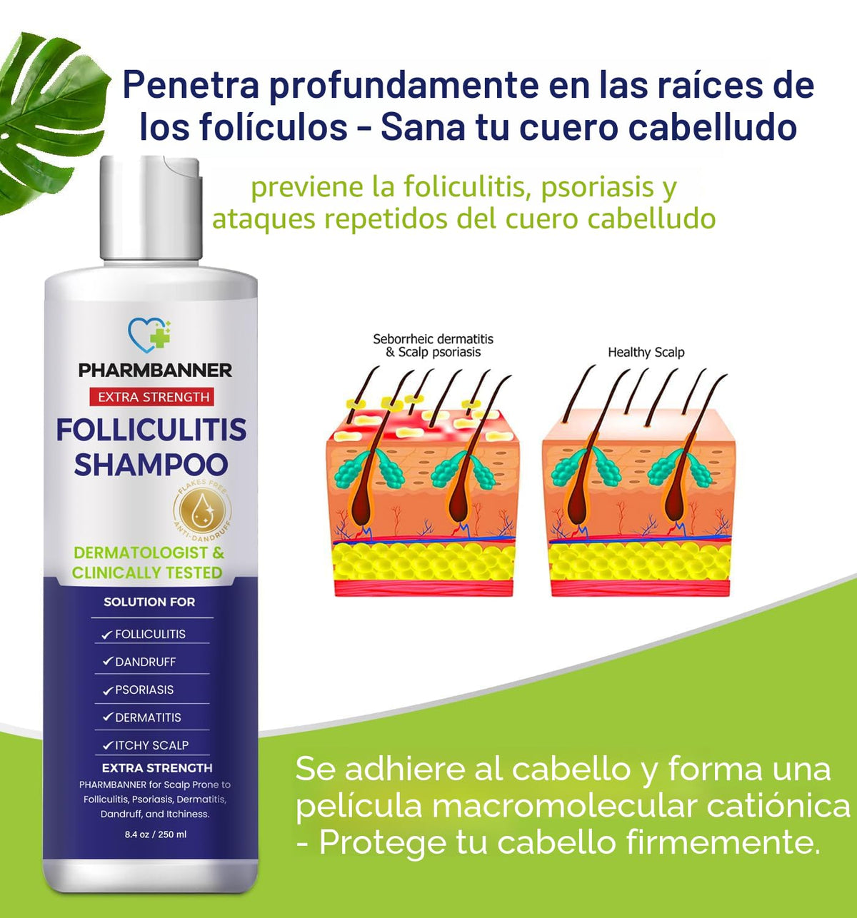 PHARMBANNER Champú antifúngico para foliculitis, dermatitis seborre...