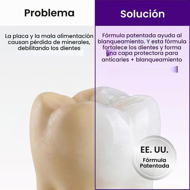 HIMALAYA PINKSALT Pasta dental morada - Removedor profundo de manch...
