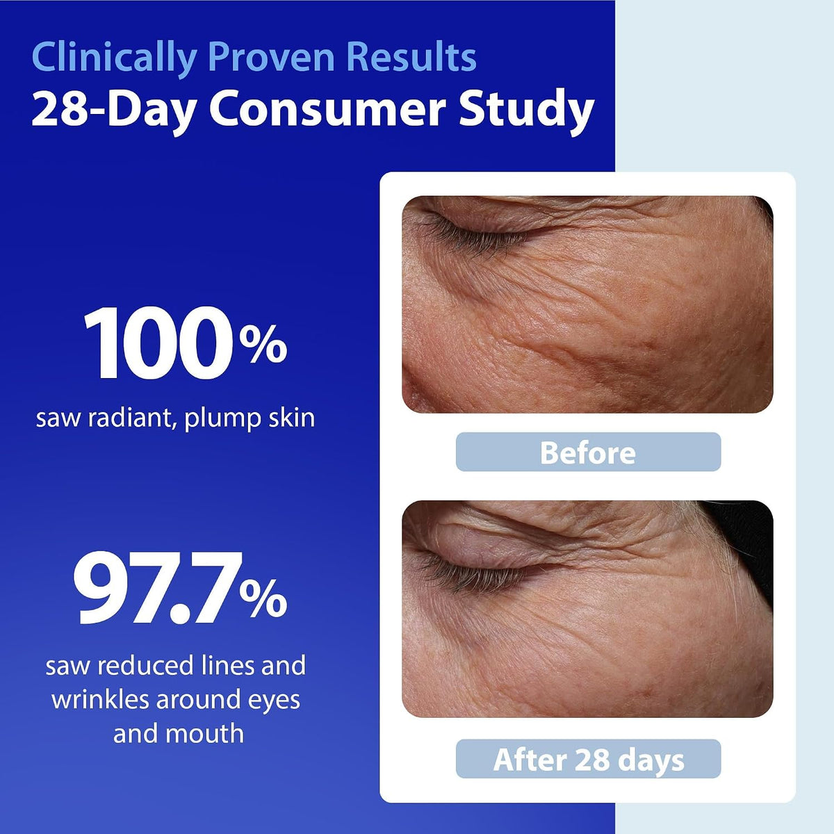 Dr. Denese SkinScience HydroShield - Suero facial ultra hidratante...