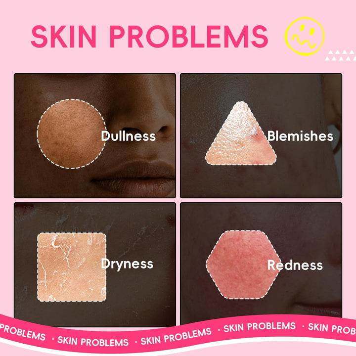 QUIYUM Watermelon &amp; Niacinamide Skincare Heroes (5 piezas), set...