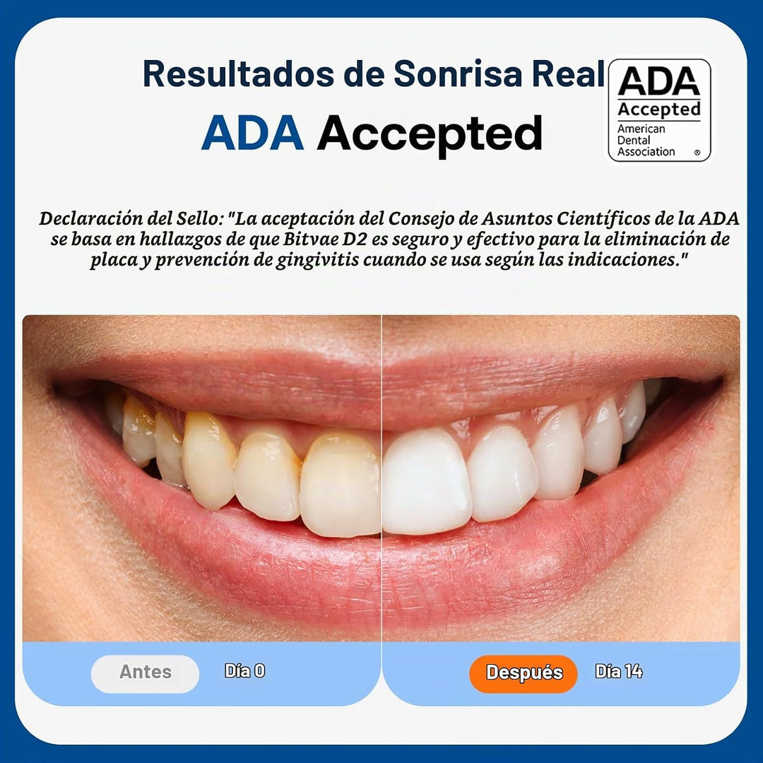 Cepillo de dientes eléctrico ultrasónico Bitvae para adultos y niño...