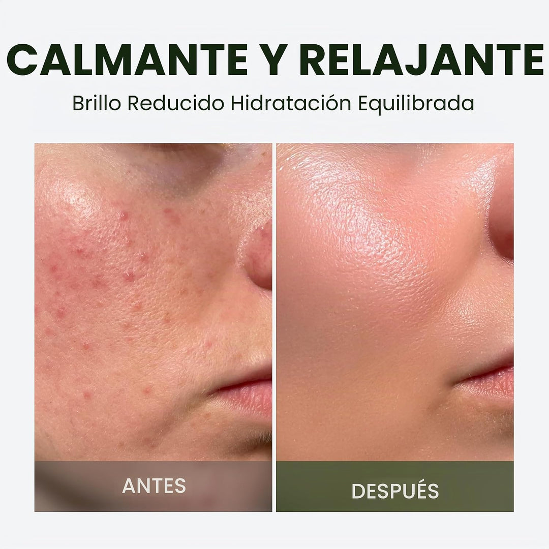 elravie HyCicaMue Crema de defensa, hidratante coreano calmante par...