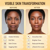 Walker Skin Protect Serum, Walker Skin Protect para mujeres negras,...