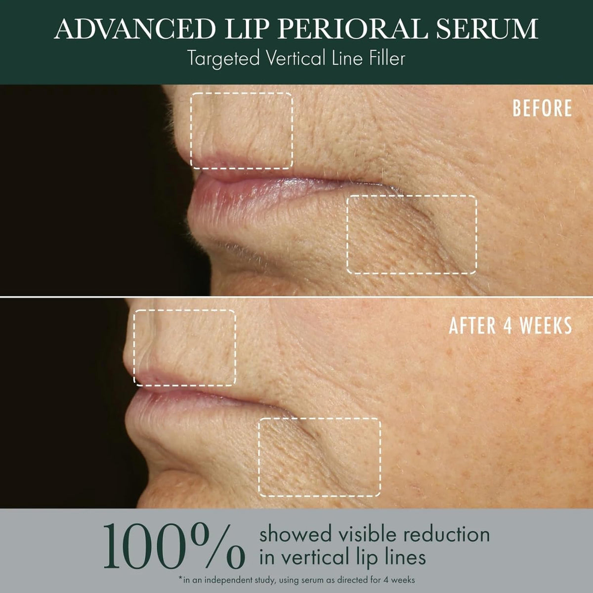 RéVive Advanced Perioral Lip Serum \u2013 Tratamiento de labios per...
