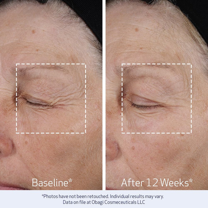 Obagi ELASTIderm Lift Up &amp; Sculpt - Crema facial antienvejecimi...