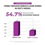 JUMISO Niacinamide 2% Oil Control Moisturizer \u2013 Crema de gel d...