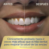 Waterpik - Irrigador de agua portátil inalámbrico avanzado, recarga...