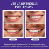 Tiras blanqueadoras de dientes moradas avanzadas, tratamiento de co...