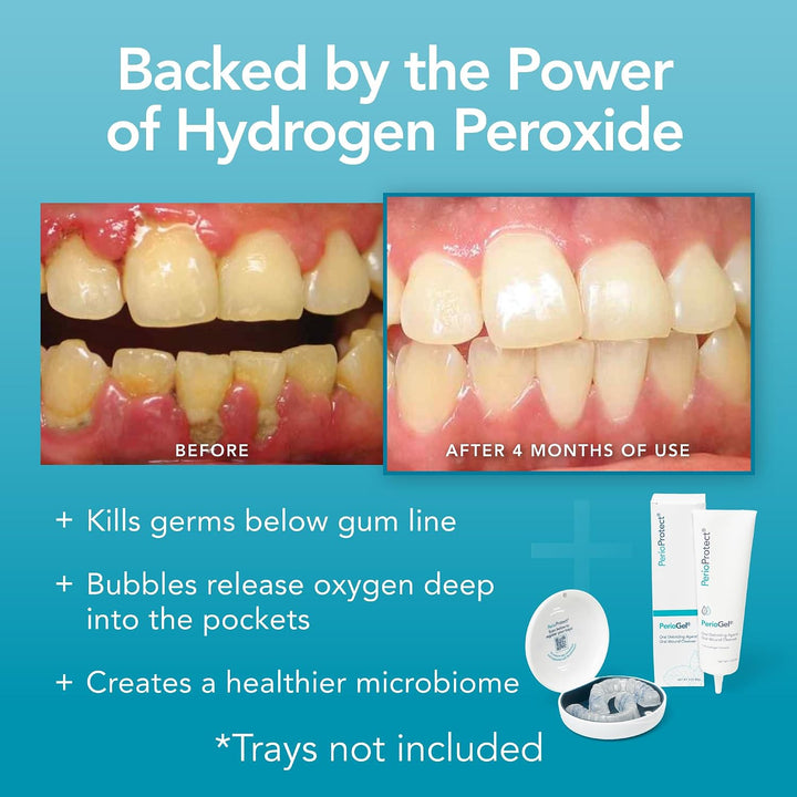 Gel Periódico | Tratamiento periodontal para dientes | Promueve el...