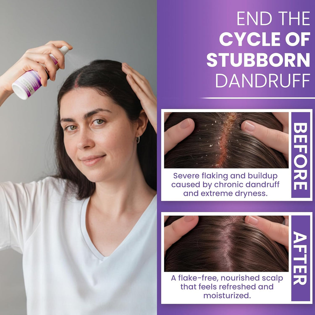 Neoketramin Spray antifúngico para el cuero cabelludo | Tratamiento...