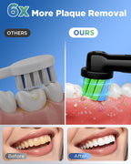 Cepillo de dientes eléctrico para adultos, 8 cabezales de cepillo de repuesto con temporizador inteligente de 2 minutos y 5 modos de limpieza, cepillo de dientes giratorio recargable con