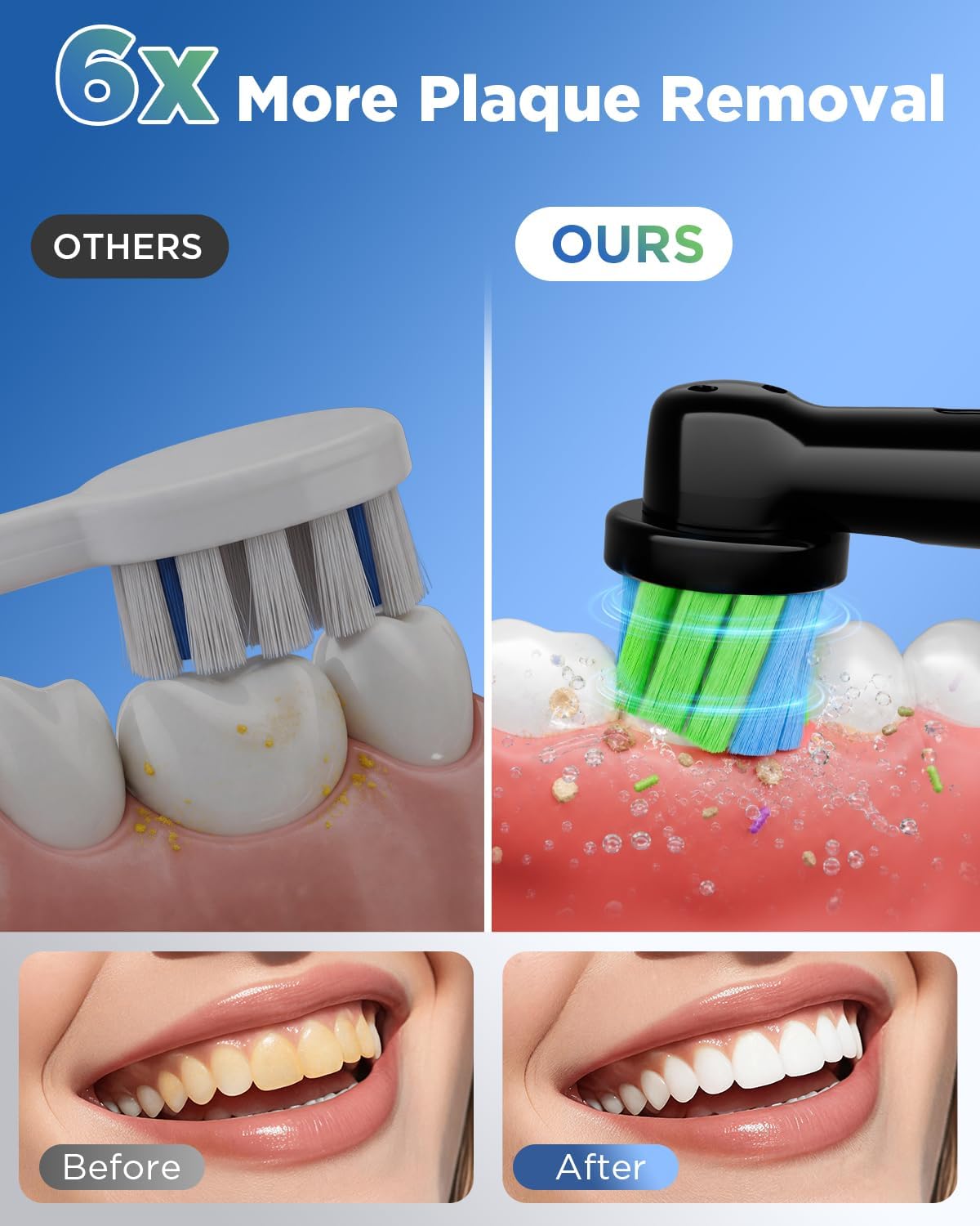 Cepillo de dientes eléctrico para adultos, 8 cabezales de cepillo de repuesto con temporizador inteligente de 2 minutos y 5 modos de limpieza, cepillo de dientes giratorio recargable con