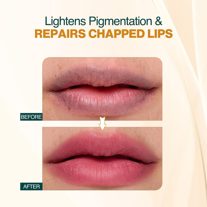 Nourish Mantra - Bálsamo labial Rose Repair con SPF | Fabricado con...