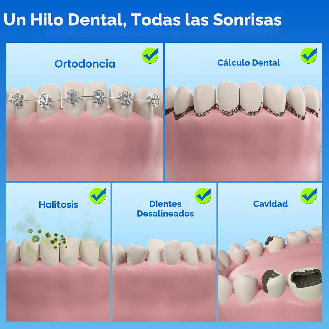 Nicwell - Irrigador dental inalámbrico con puntas para hilo dental...