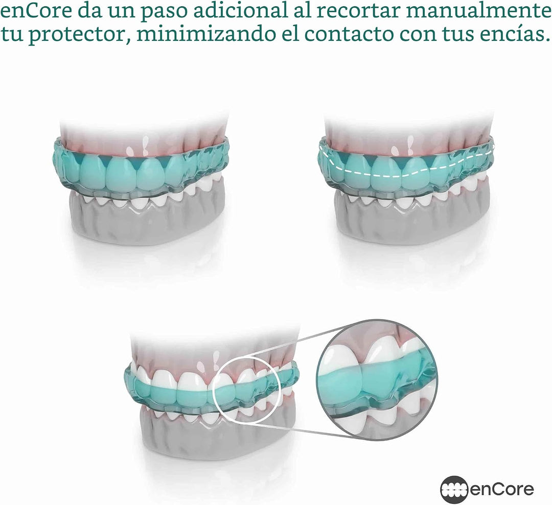 EnCore Guards - Guardia nocturna dental personalizada para protecci...