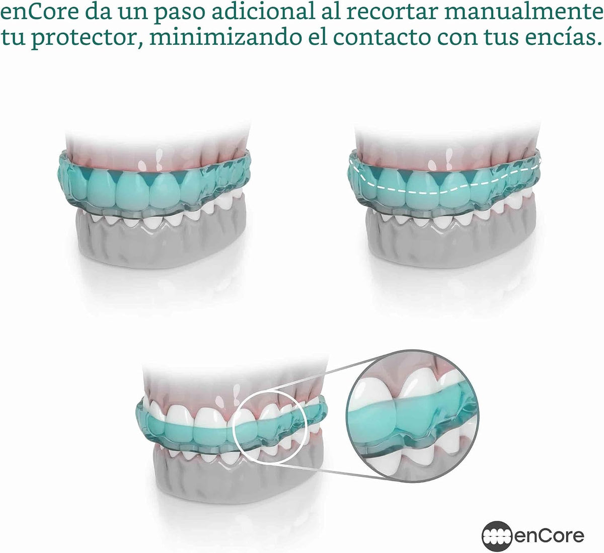 EnCore Guards - Guardia nocturna dental personalizada para protecci...