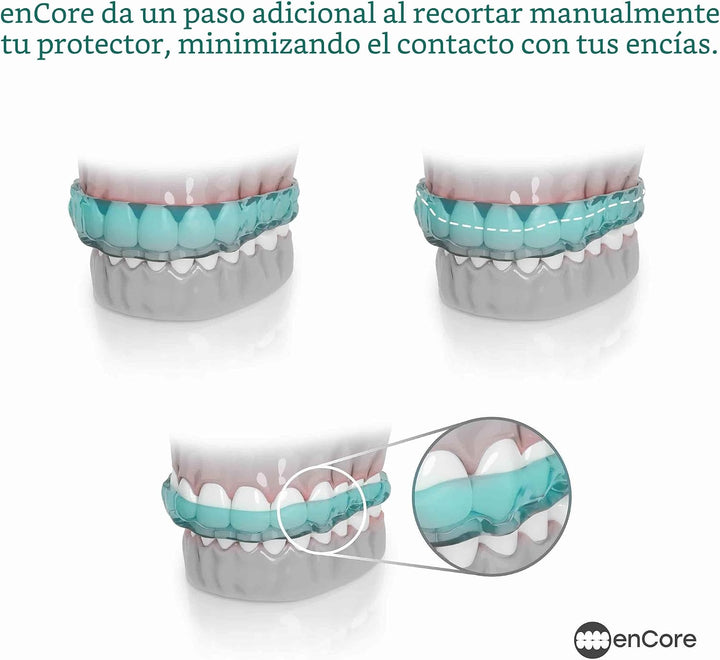 EnCore Guards - Guardia nocturna dental personalizada para protecci...
