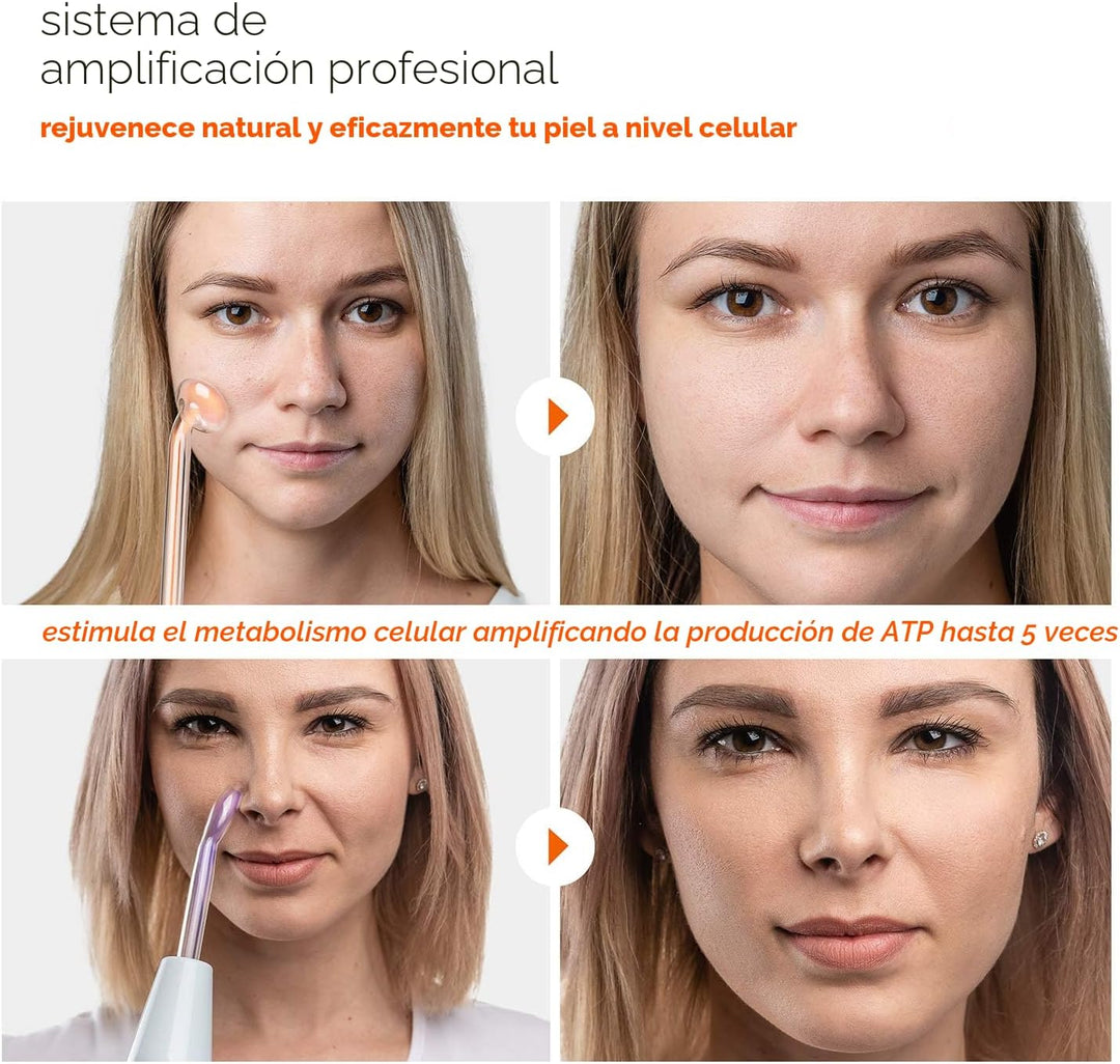 NuDerma - Varita de terapia profesional para la piel - Máquina port...