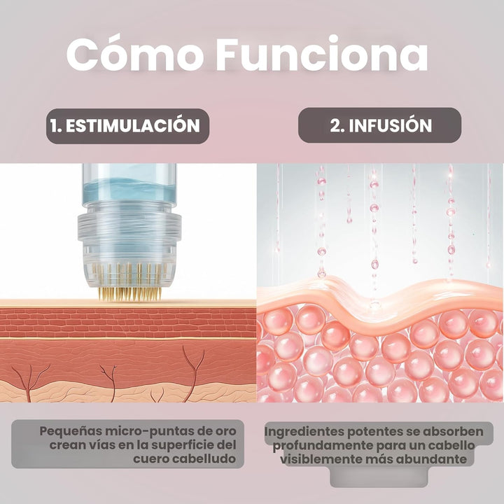 Kit de Renovación Capilar Micro Infusión de Glov Beauty \u2013 Esta...