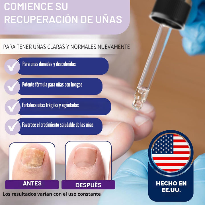 ZanaQuick - Gotas de reparación extrafuerte para uñas de los pies y...