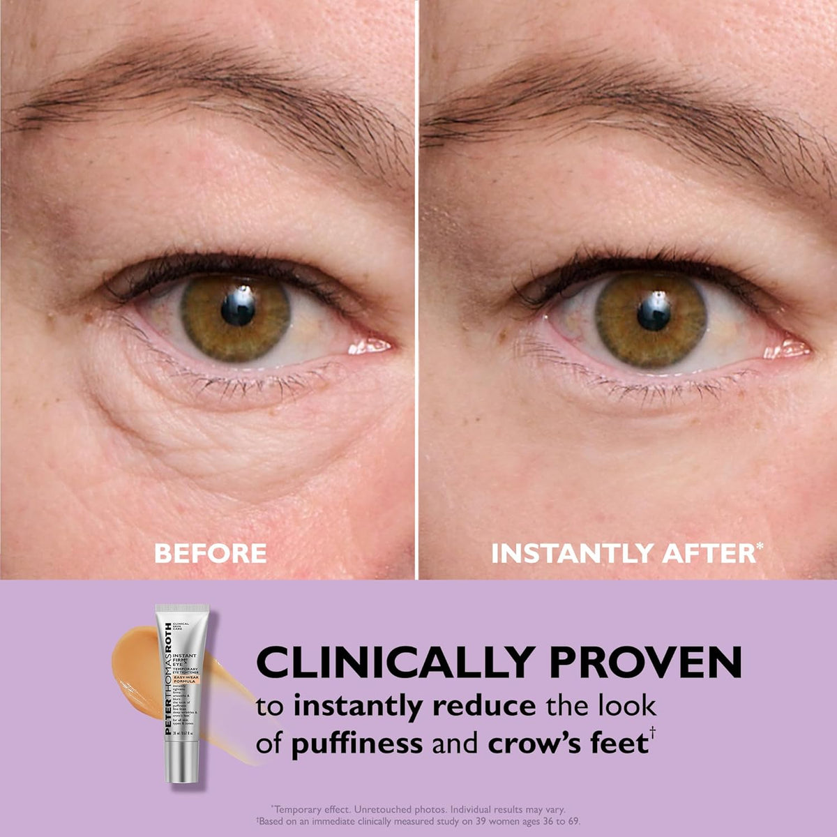 Peter Thomas Roth | Tensor de ojos temporal FIRMx® Fórmula de fácil...