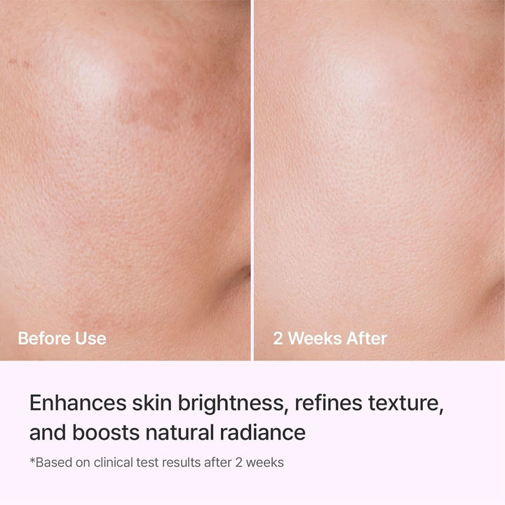 REJURAN® Ampolla Triple Radiance 1.0 fl oz \u2013 DOT™ c-PDRN 0.5%...