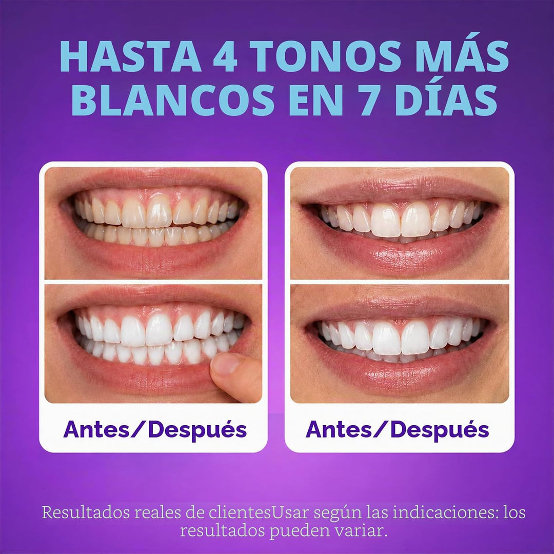 SAKYPRORAL Tiras blanqueadoras moradas, resultados de larga duració...