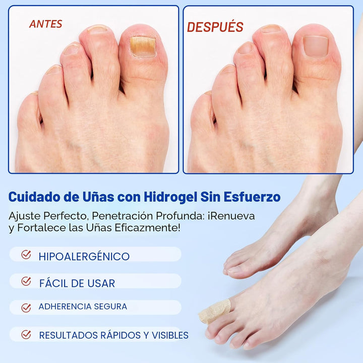 Parches de uñas: 21 parches de reparación extra fuertes para uñas d...