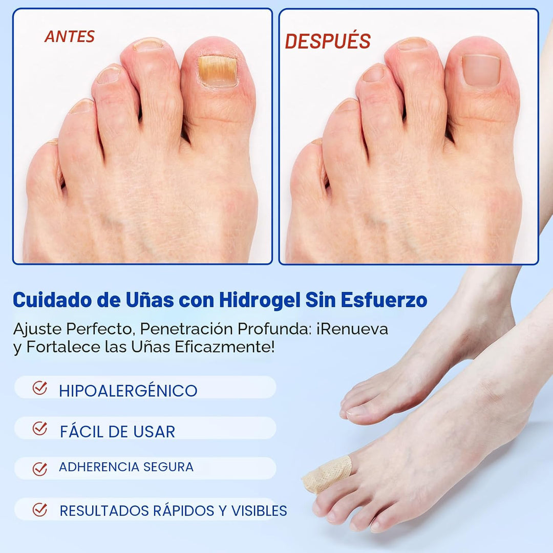Parches de uñas para reparación de uñas de los pies \u2013 42 pieza...