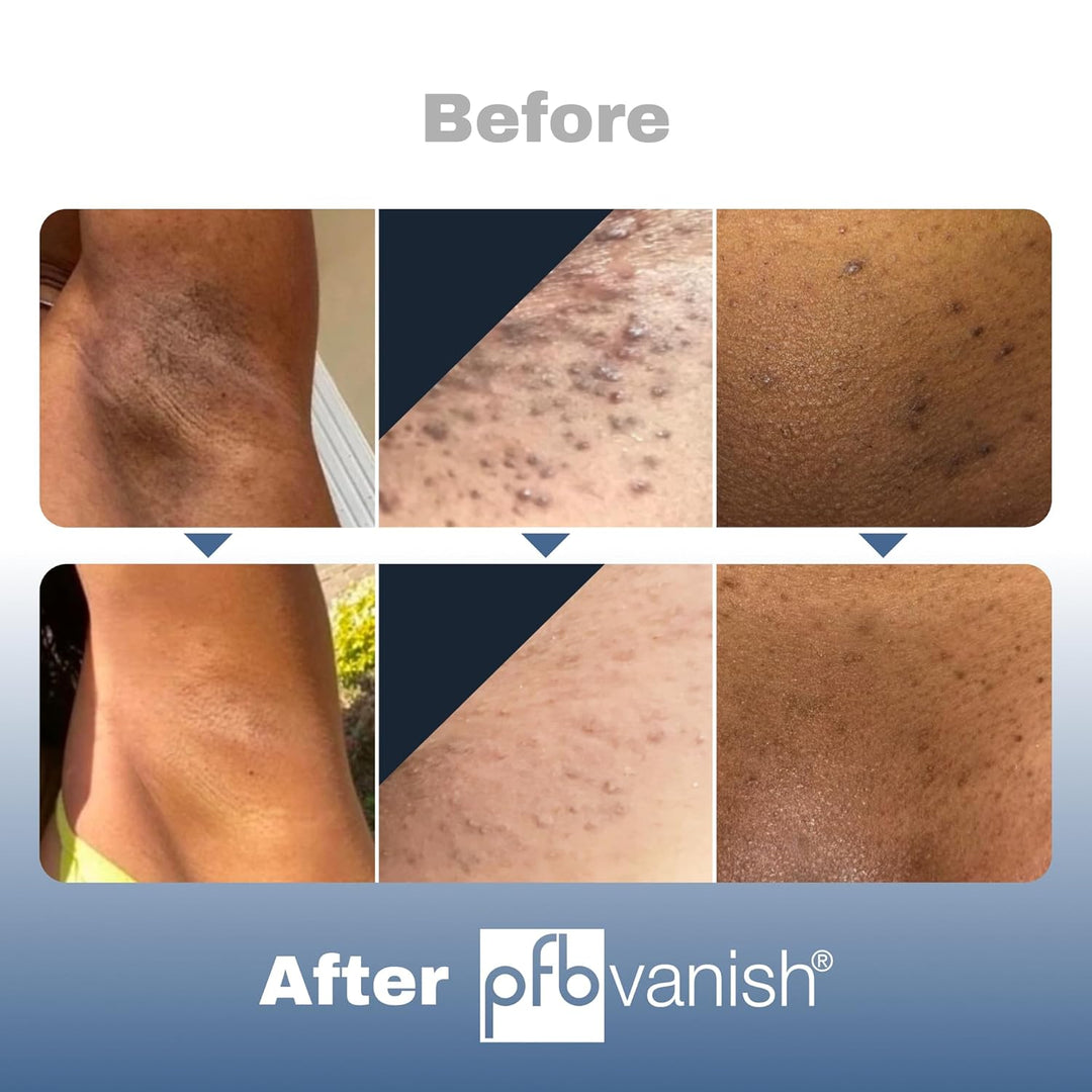 PFB Vanish + Chromabright, 3.3 oz