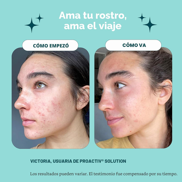 Kit de principiante, sistema de tratamiento acné de 3 pasos PROACTI...