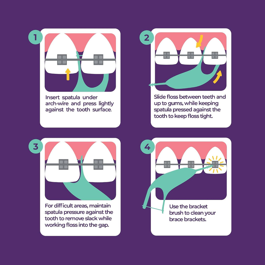 Platypus Hilo Dental Ortodóntico para Brackets, 30 Unidades (Paquet...