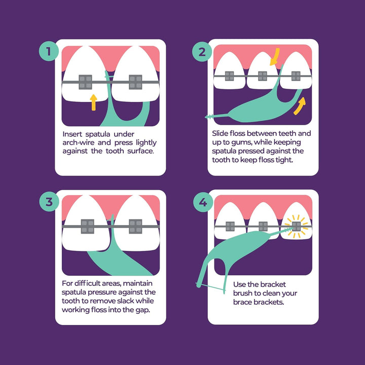 Platypus Hilo dental ortodóncico para aparatos, 30 unidades (paquet...