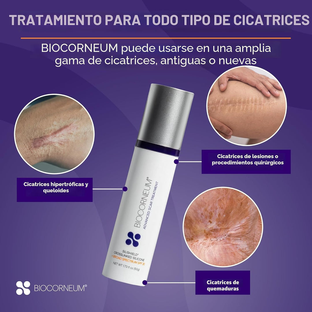 Supervisión avanzada de cicatrices con FPS 30 bioCorneum (tamaño: 1...