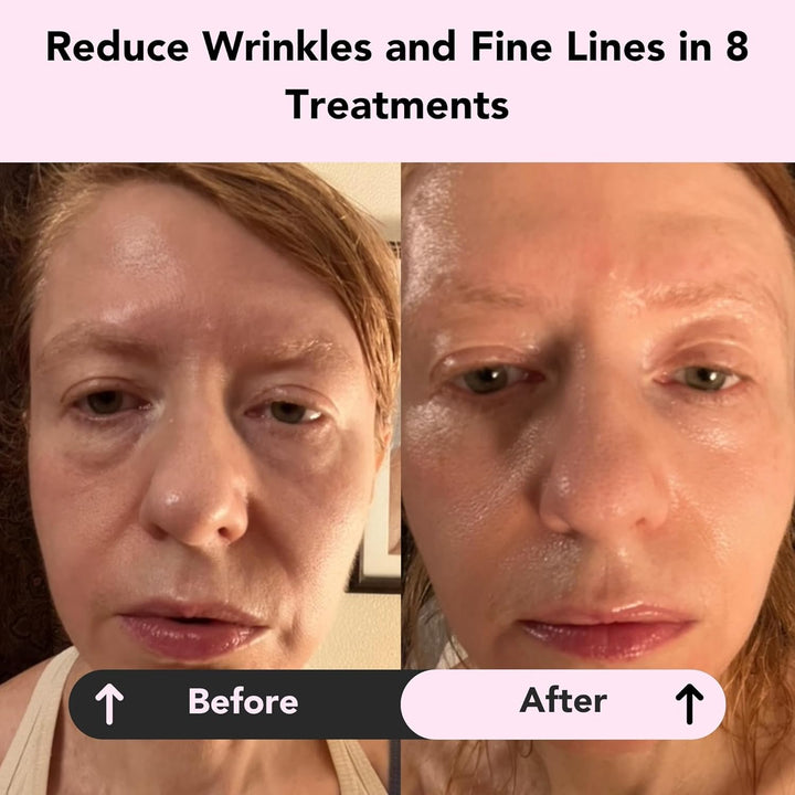 Glorio RENEW: 8 tratamientos de mascarilla de arcilla que aumentan...