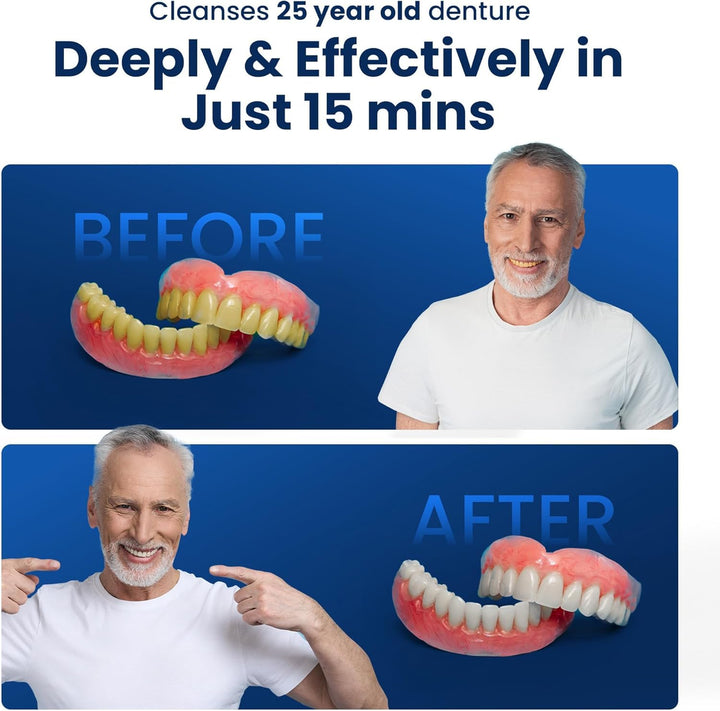 iSonic F3900 Limpiador ultrasónico para prótesis dental\/alineador\...