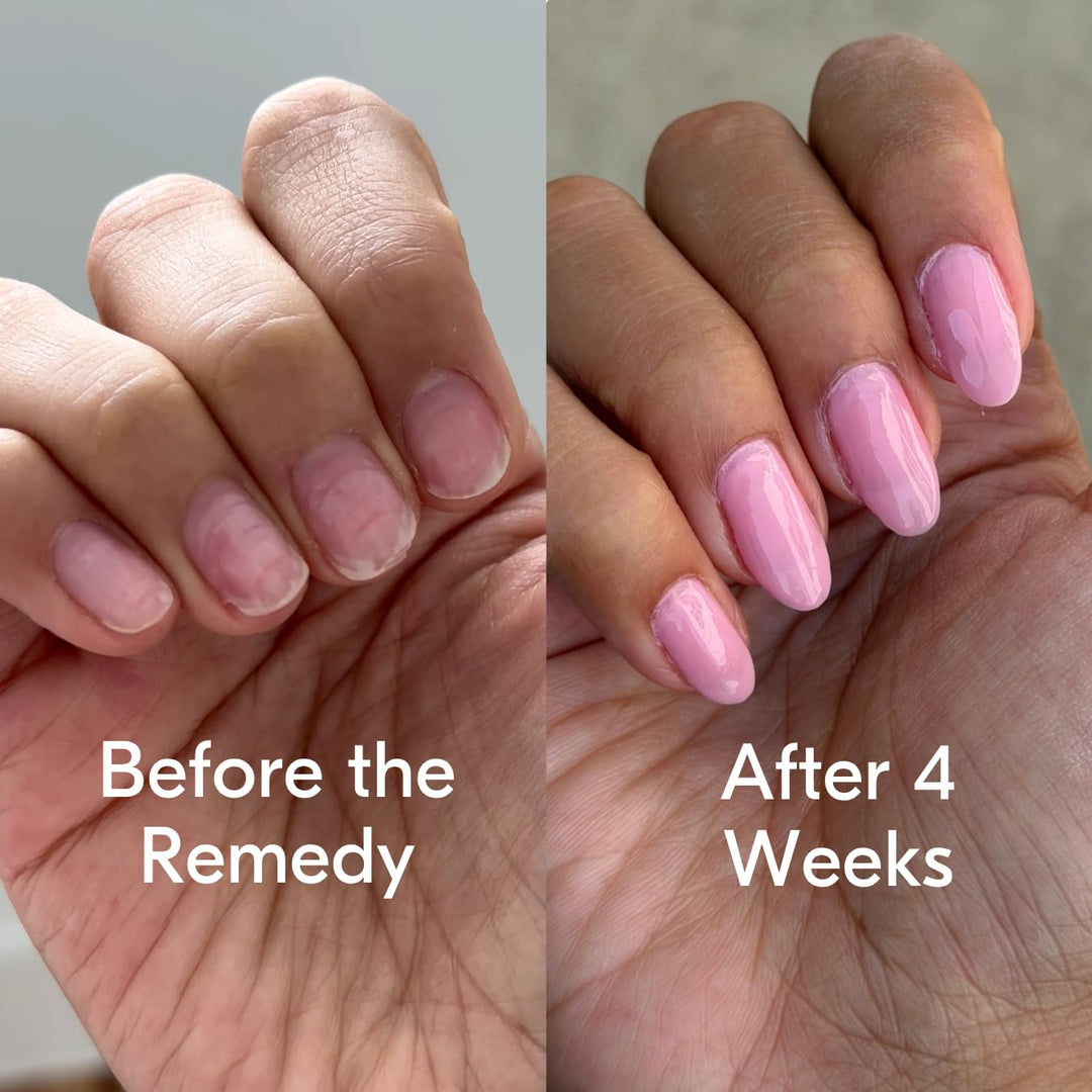 Botanist The Remedy - Esmalte fortalecedor de uñas, repara y endure...