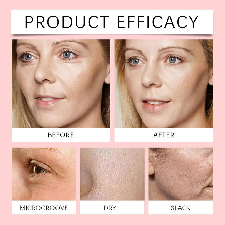 Suero de Vitaminas Finones Skin para rostro y cuerpo, suero reafirm...
