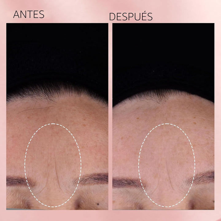 Cápsulas de suero facial de retinol + HPR de ceramidas de Elizabeth...