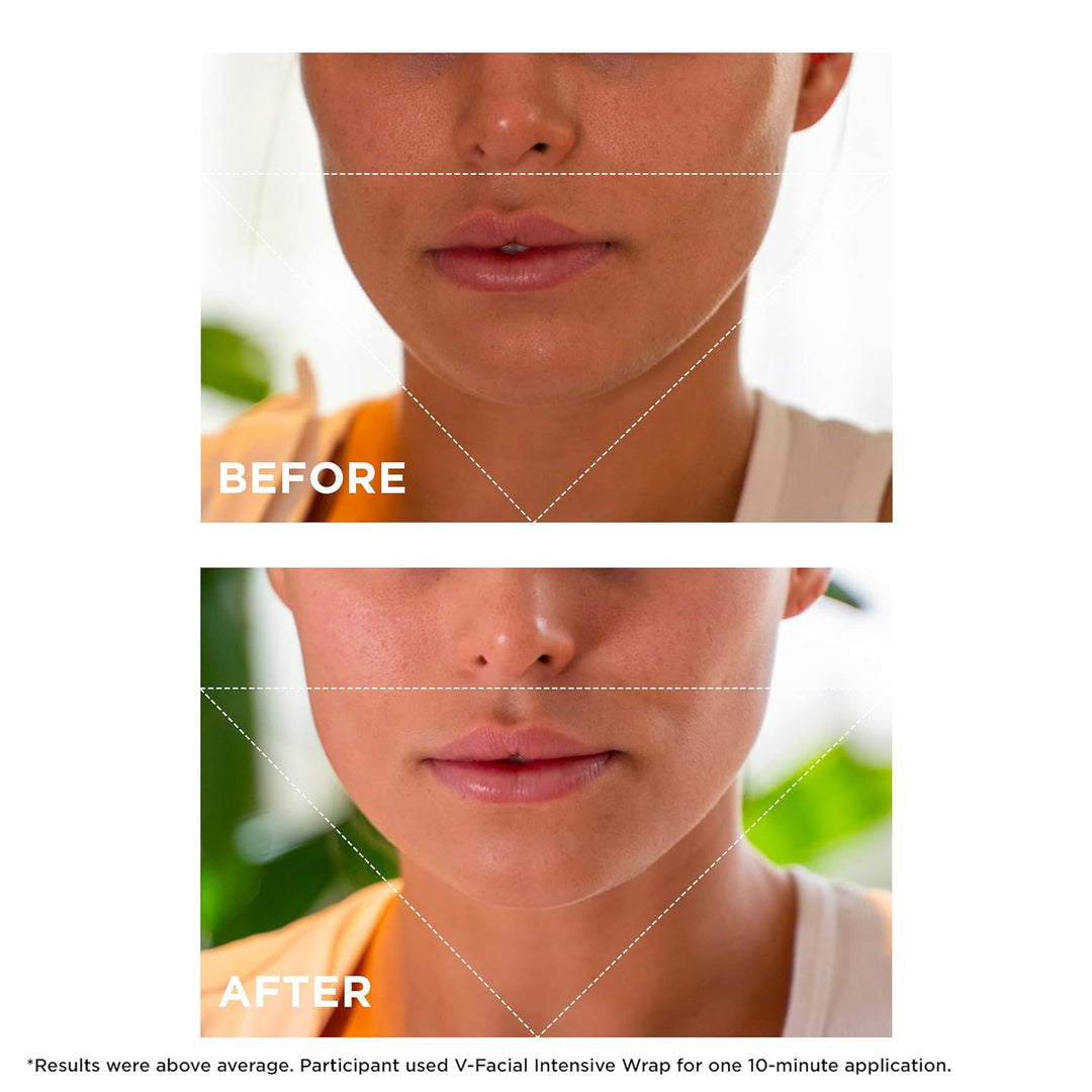 CLARINS Máscara facial Cryo-Flash | Efecto de elevación visible en...