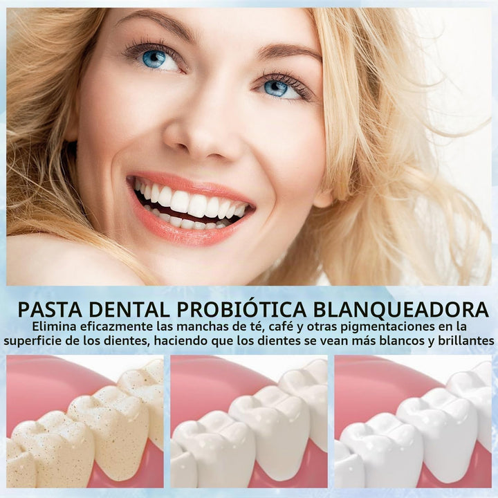 Pastas dentales de hidroxiapatita para la protección del esmalte y...