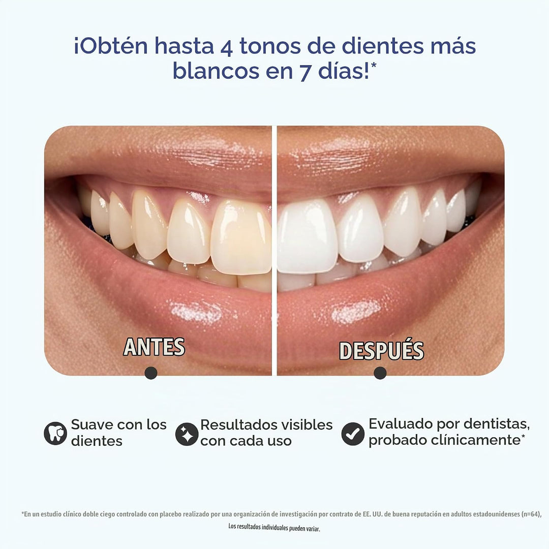 GuruNanda Kit de tiras blanqueadoras dentales, tratamiento de 30 dí...