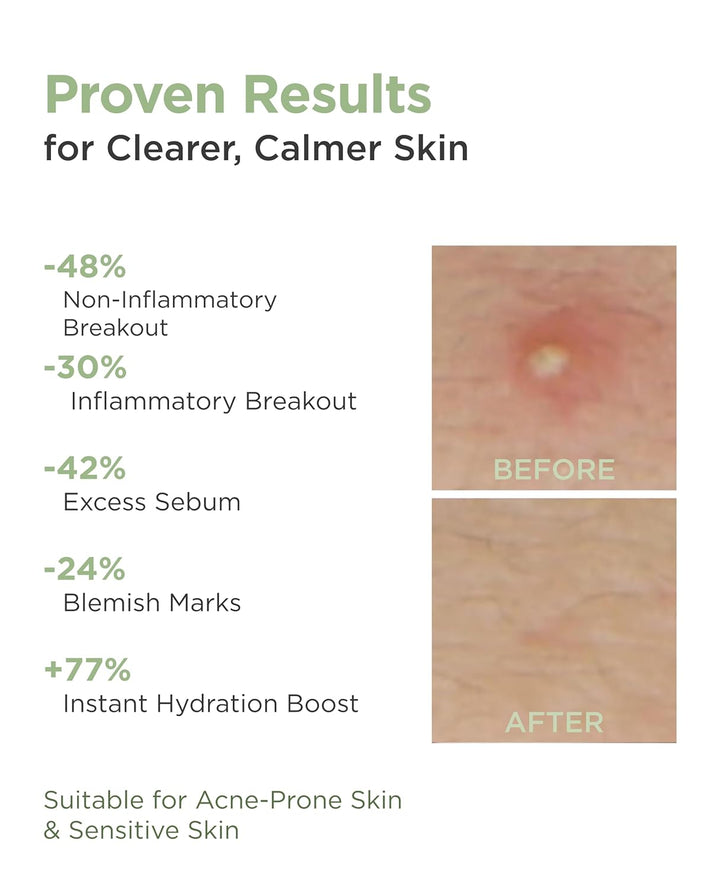 AROCELL - Máscara facial de hidrogel Cica PDRN, 4 hojas faciales co...