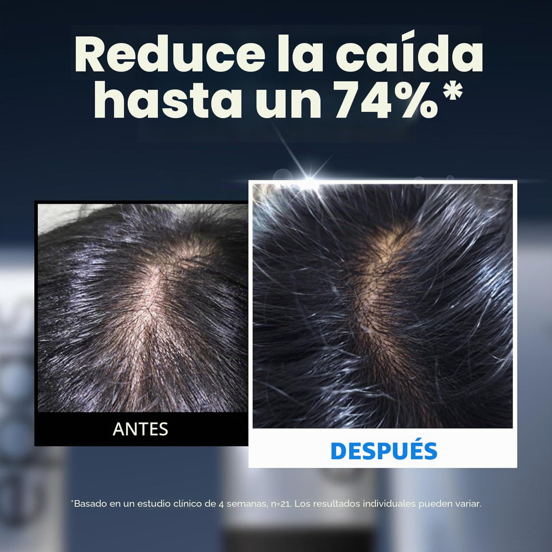 EPAIS Suero potenciador del cuero cabelludo (cuidado completo del c...