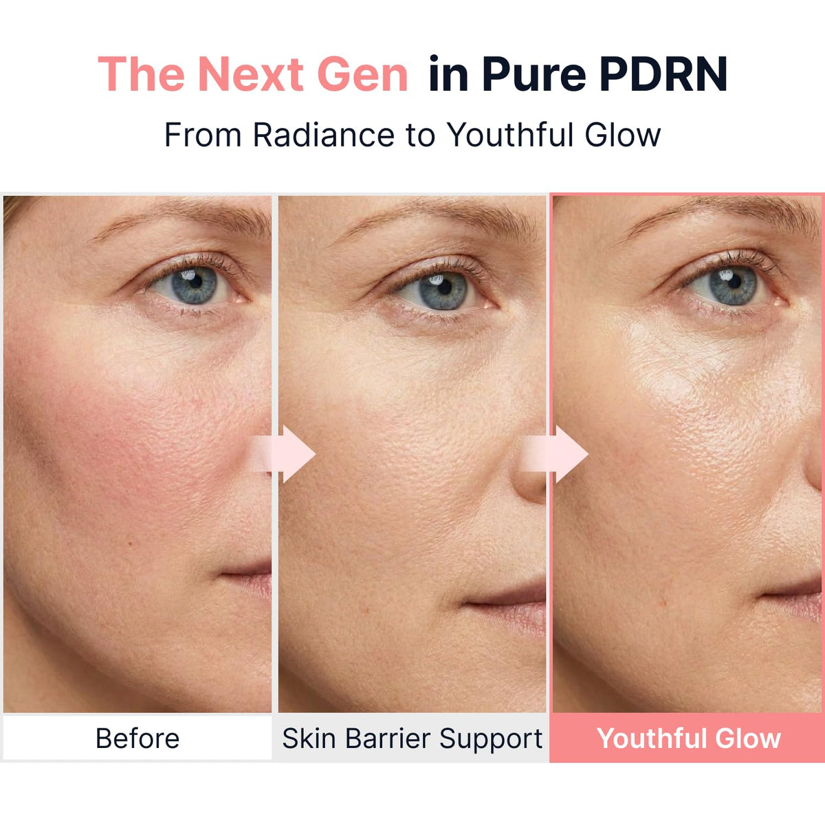 SUNGBOON EDITOR Glow - Ampolla PDRN intensiva, péptidos de cobre y...