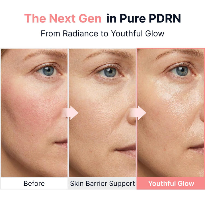 SUNGBOON EDITOR Glow - Ampolla PDRN intensiva, péptidos de cobre y...