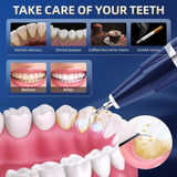 Removedor de placa para dientes, removedor de sarro para dientes, k...