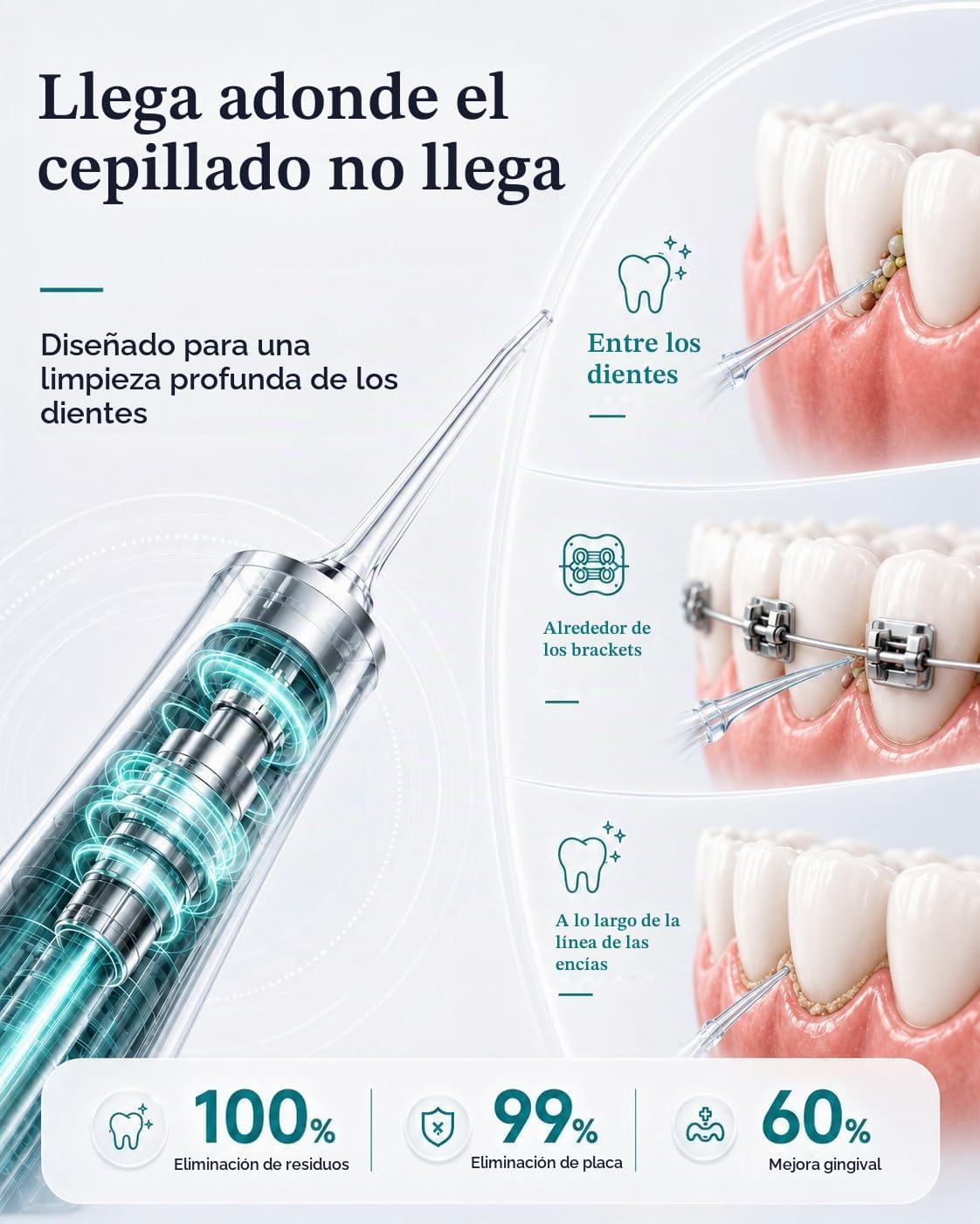 Irrigador dental inalámbrico para los dientes, irrigador oral desmontable