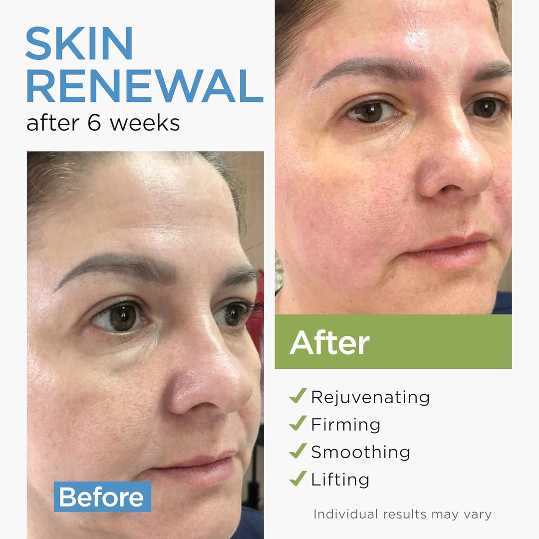 Crema facial hidratante de colágeno antienvejecimiento con células...